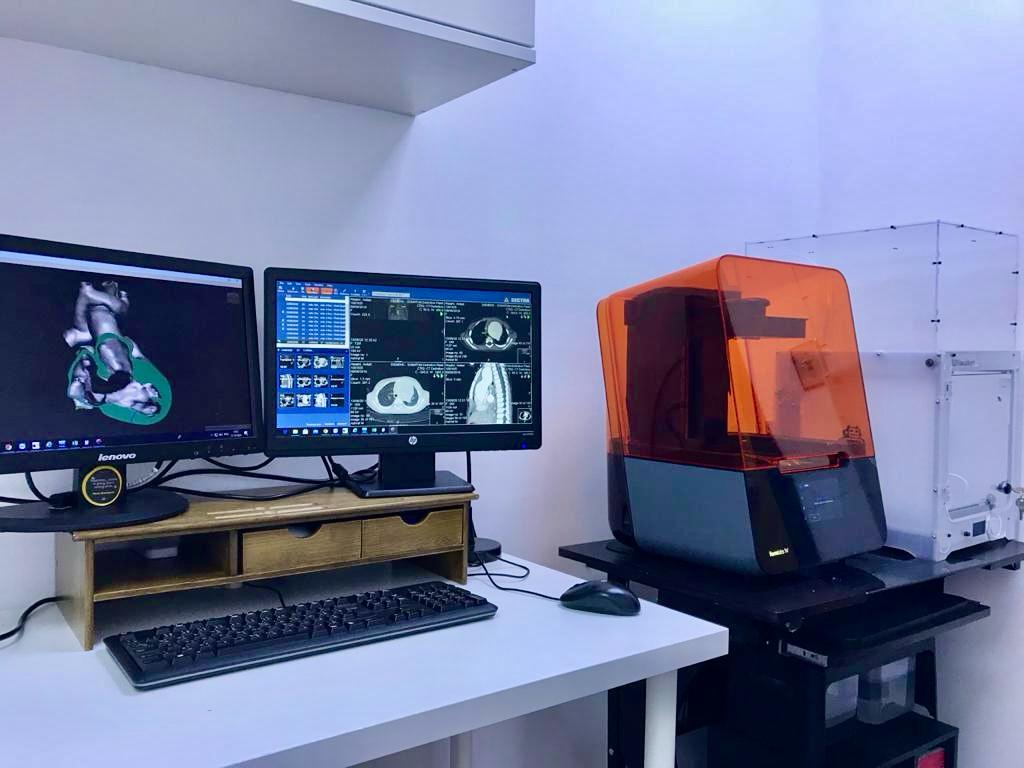 3D Technology Improves Precision in 30 Successful Pediatric Heart Surgeries at King Abdulaziz University Hospital